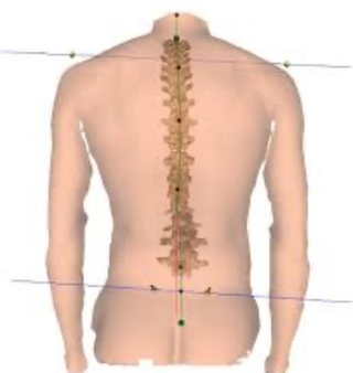 machine dos colonne vertebrale